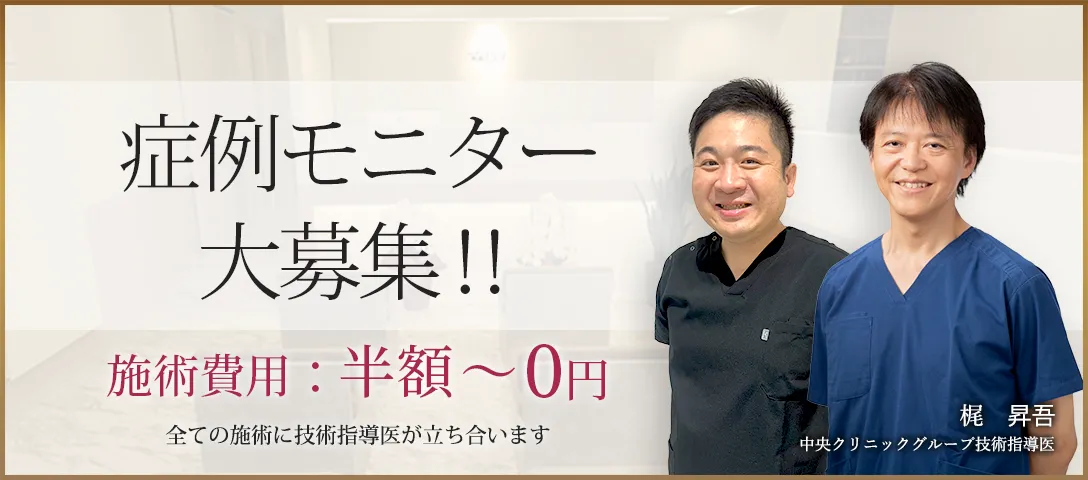 症例モニター大募集