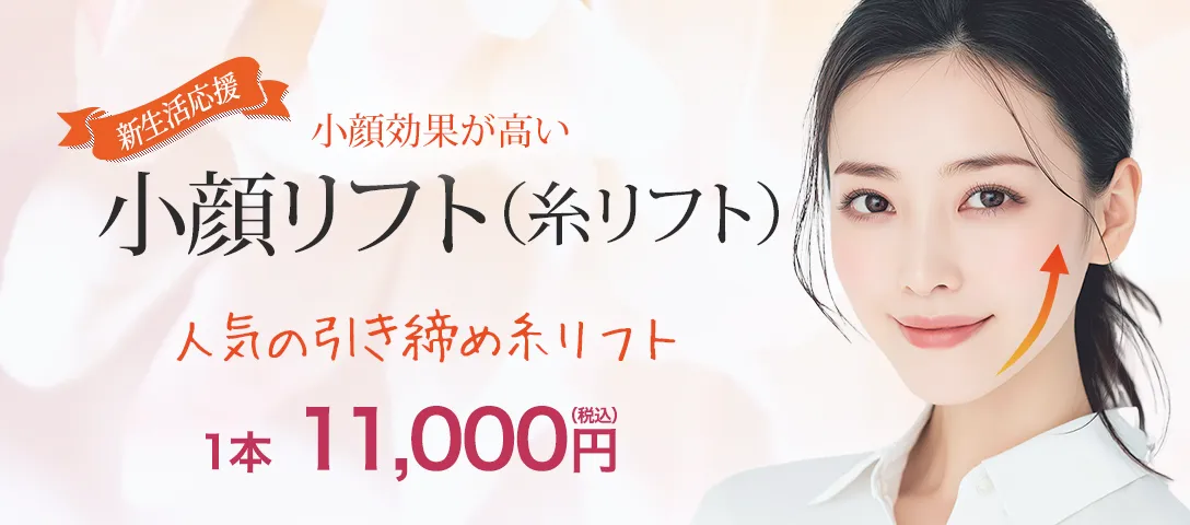 小顔リフト（糸リフト）