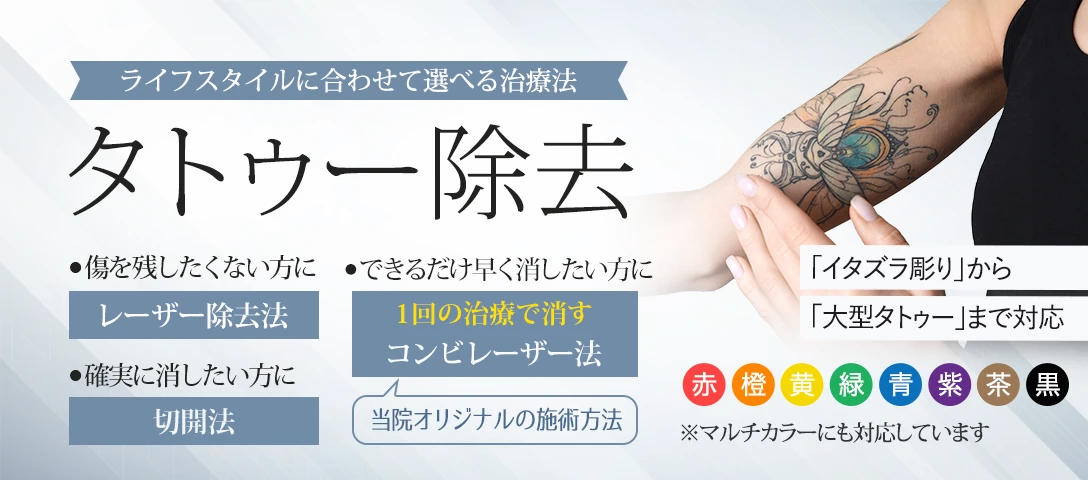 タトゥー除去