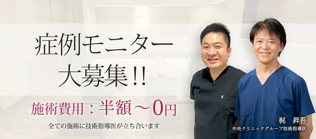 症例モニター大募集
